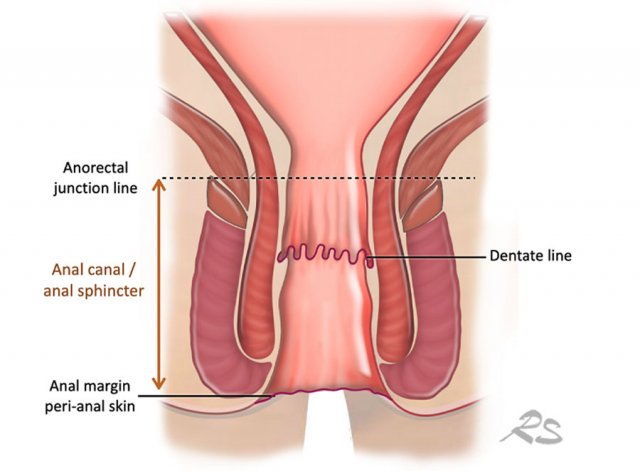 danilo fonacier recommends spontaneous anal pic