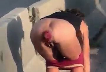 dan beyler like anal prolapse public photo cynthia urbina recommends rihanna naked leaked pic